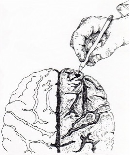 Brain